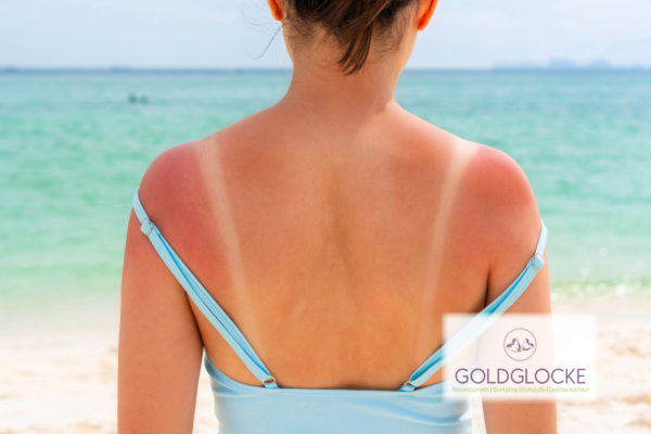 Sonnenbrand HP